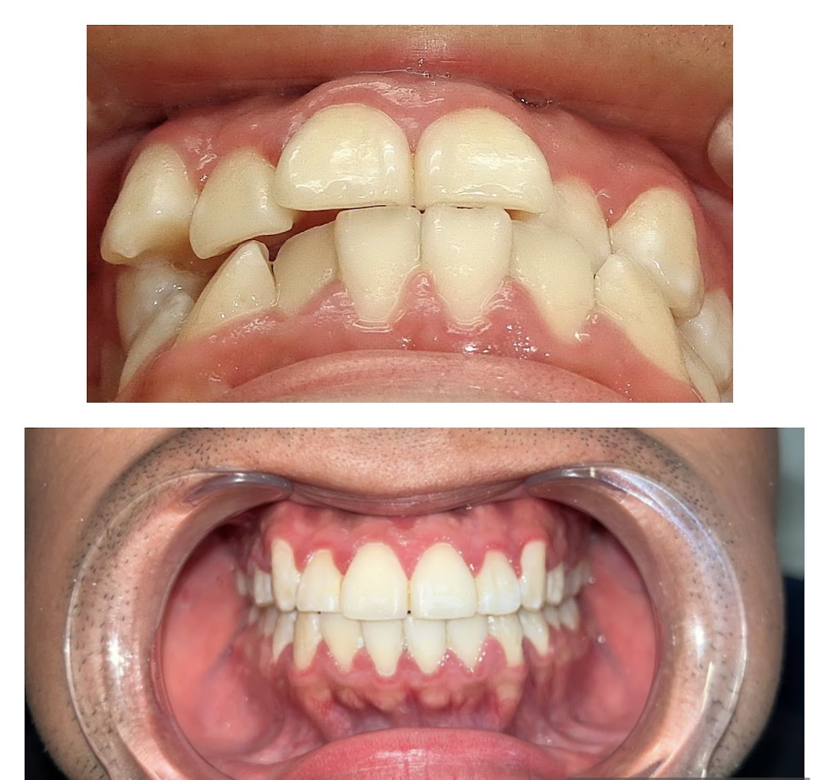 Dentista Puerta de Hierro (Dra. Andrea Berríos) — foto 2