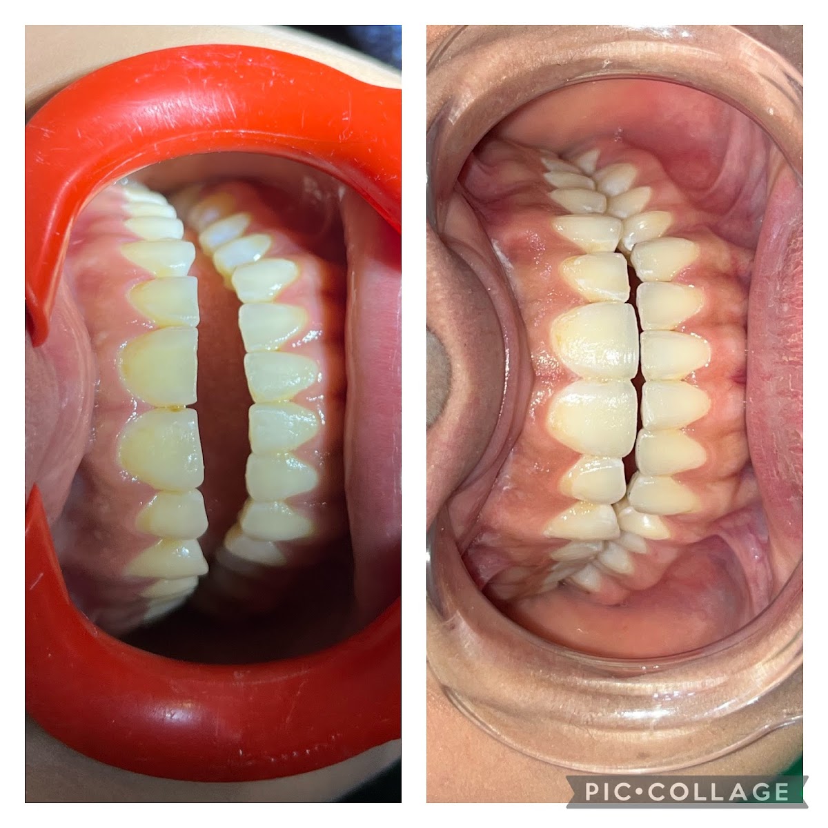 Dentista Puerta de Hierro (Dra. Andrea Berríos) — foto 3