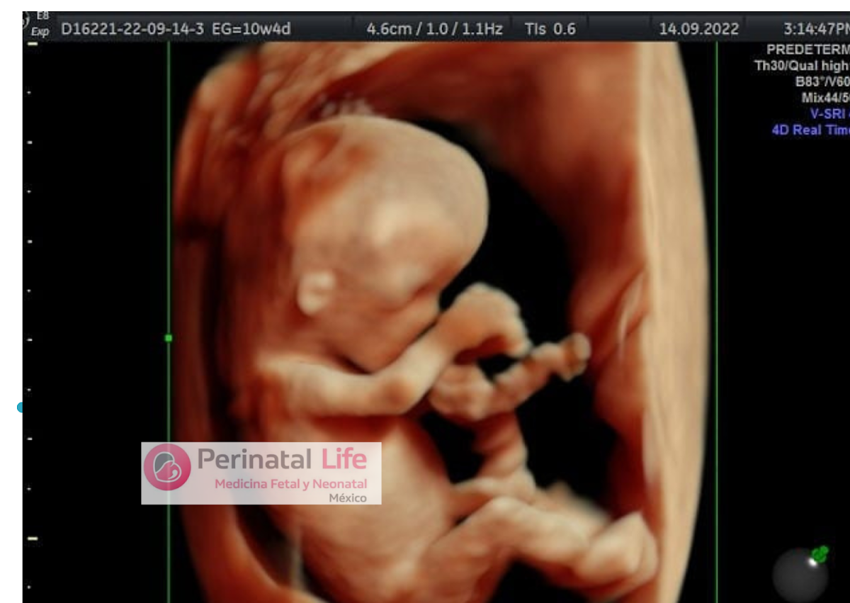 Ginecóloga/Medico Materno Fetal/Flor Casillas/Control de Embarazo/Ultrasonido Estructural/Parto y Cesárea Humanizada — foto 4