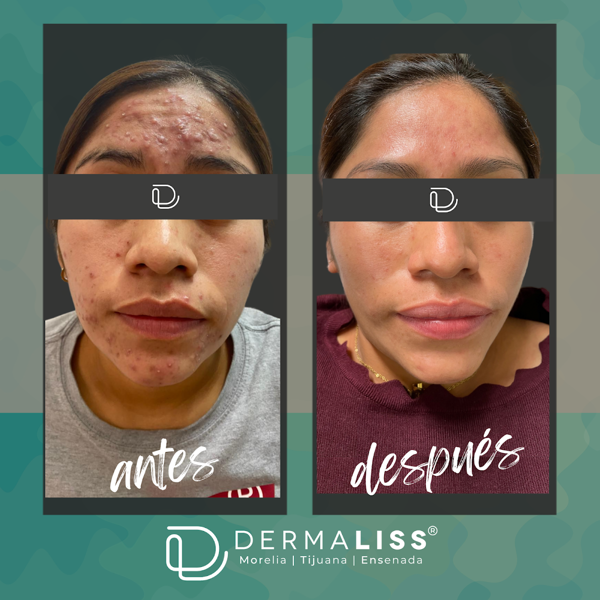 DERMALISS-Morelia Sucursal Centro, Centro Histórico