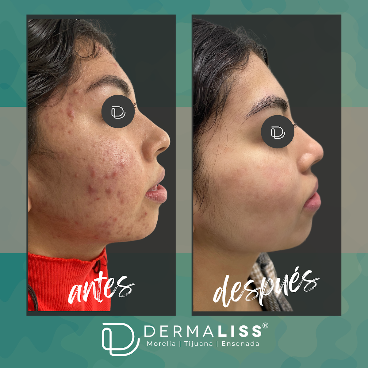 DERMALISS-Morelia Sucursal Centro — foto 3