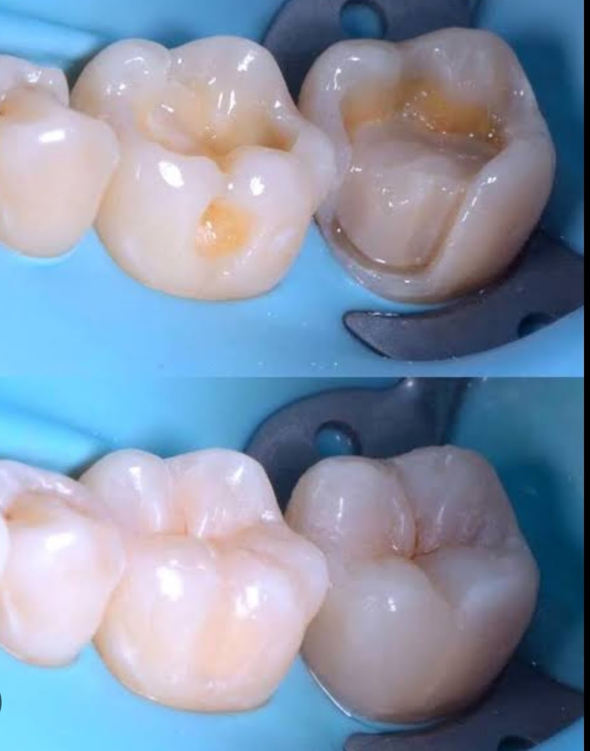 Dentalitz Especialidades Dentales — foto 2