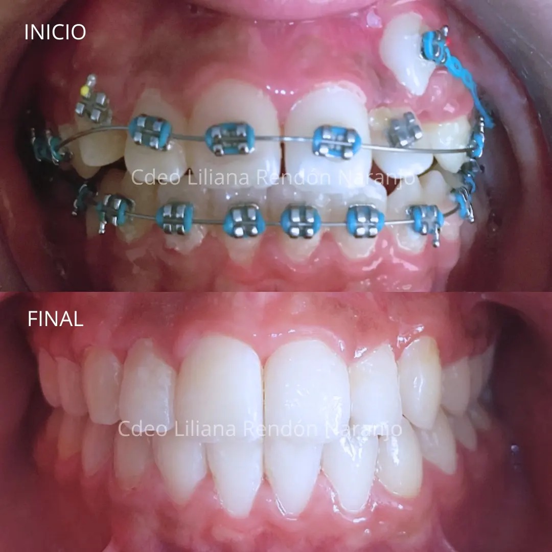 Dentalinea Morelia — foto 2