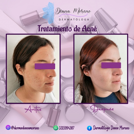 Dra. Diana Isis Moreno Nava, Dermatólogo — foto 3