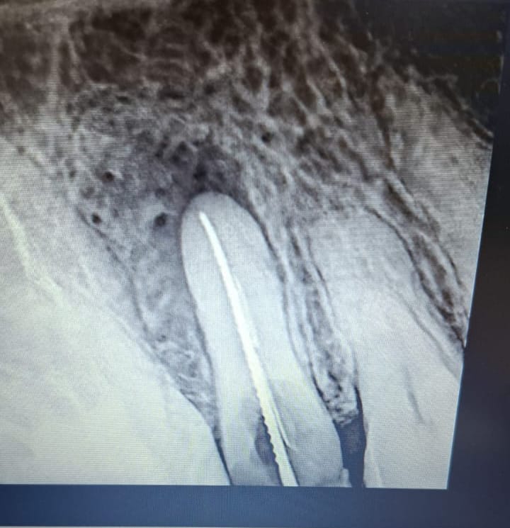 Dentista en Cancún DentalKUN — foto 2