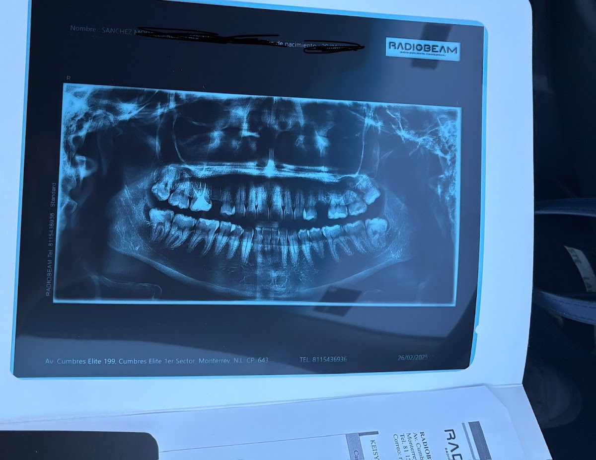 RADIOBEAM - Radiología Dental y Maxilofacial — foto 4