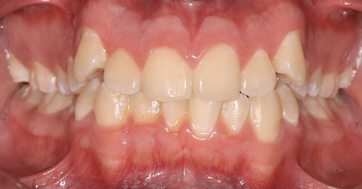 Smart Smile - Clínica Dental