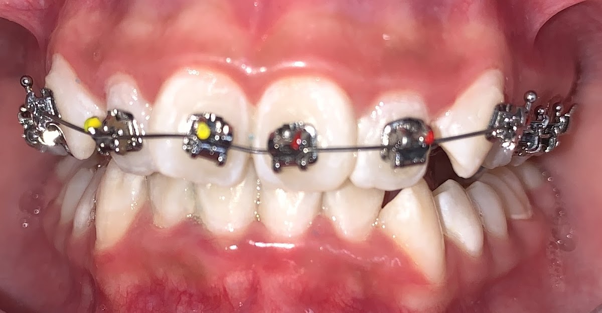Dental Fernandez Aguascalientes — foto 3