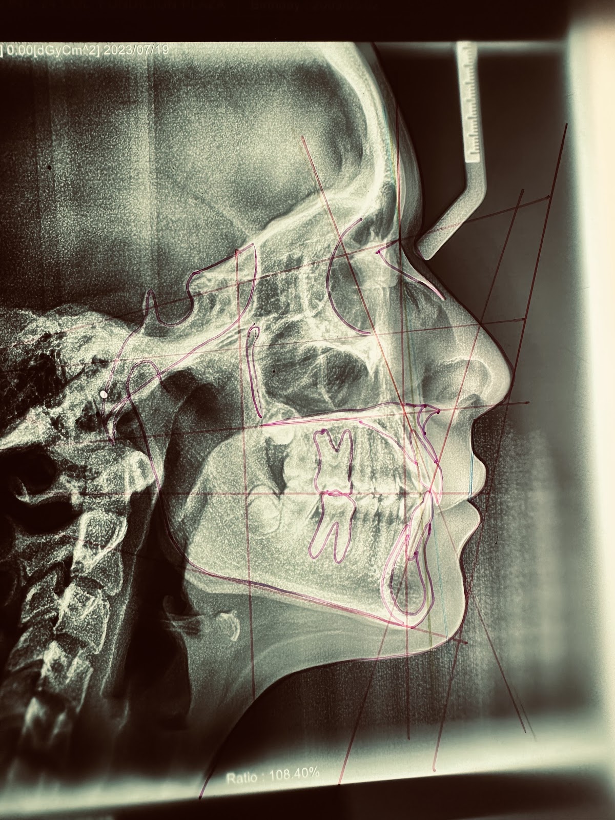 Dental Fernandez Aguascalientes — foto 4