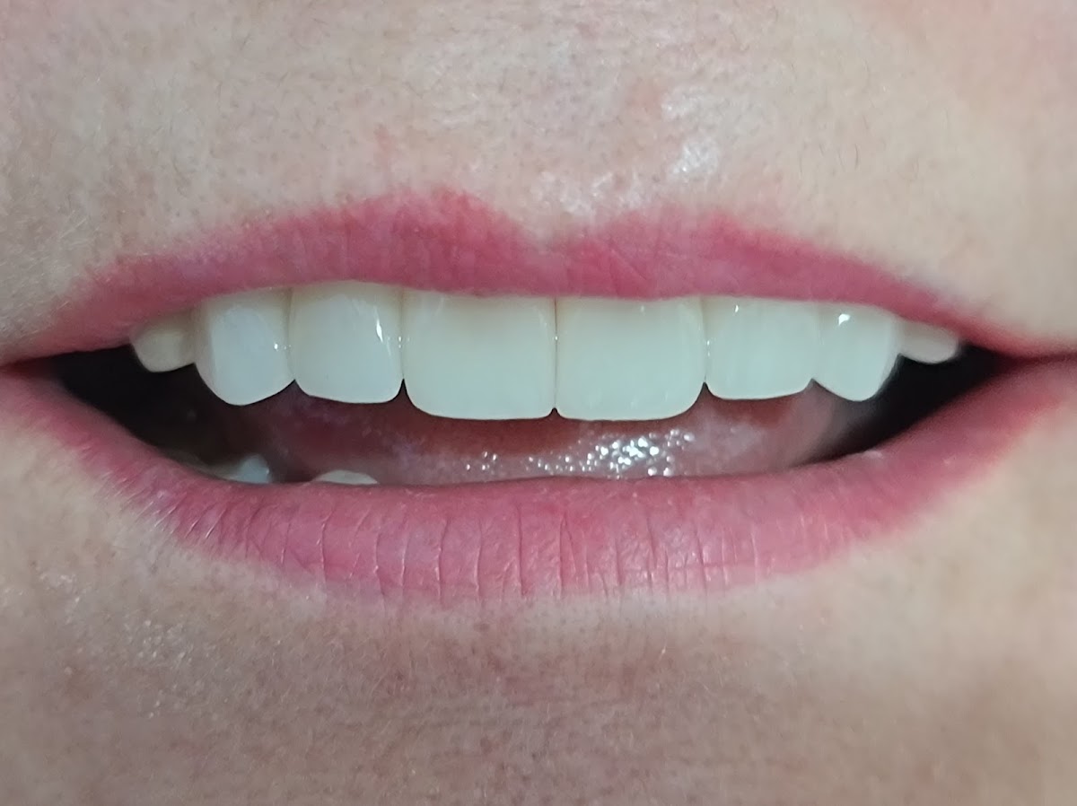YUCATÁN DENTAL Dr. Jesús Sanchez Ruz — foto 4