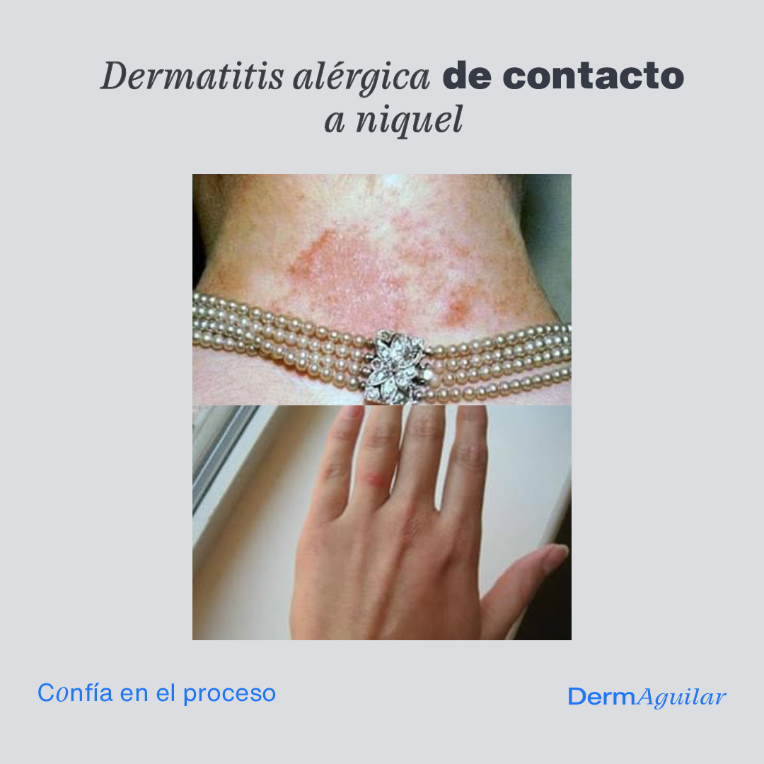Dermaguilar