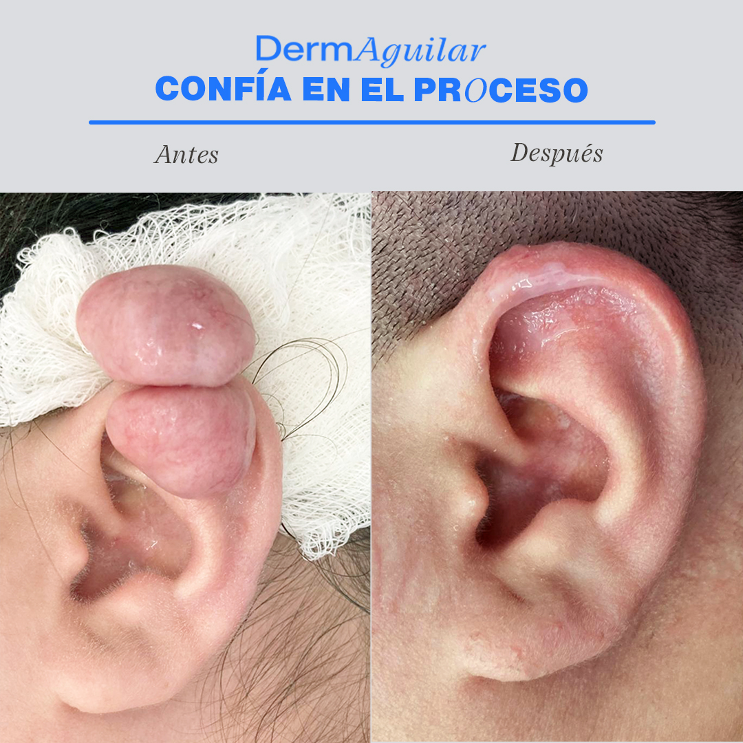 Dermaguilar — foto 2