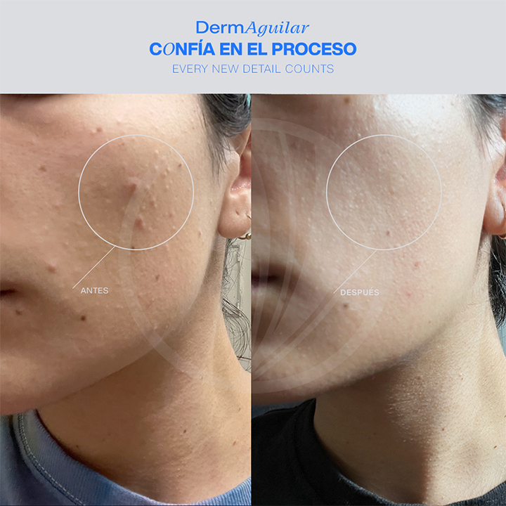 Dermaguilar — foto 4