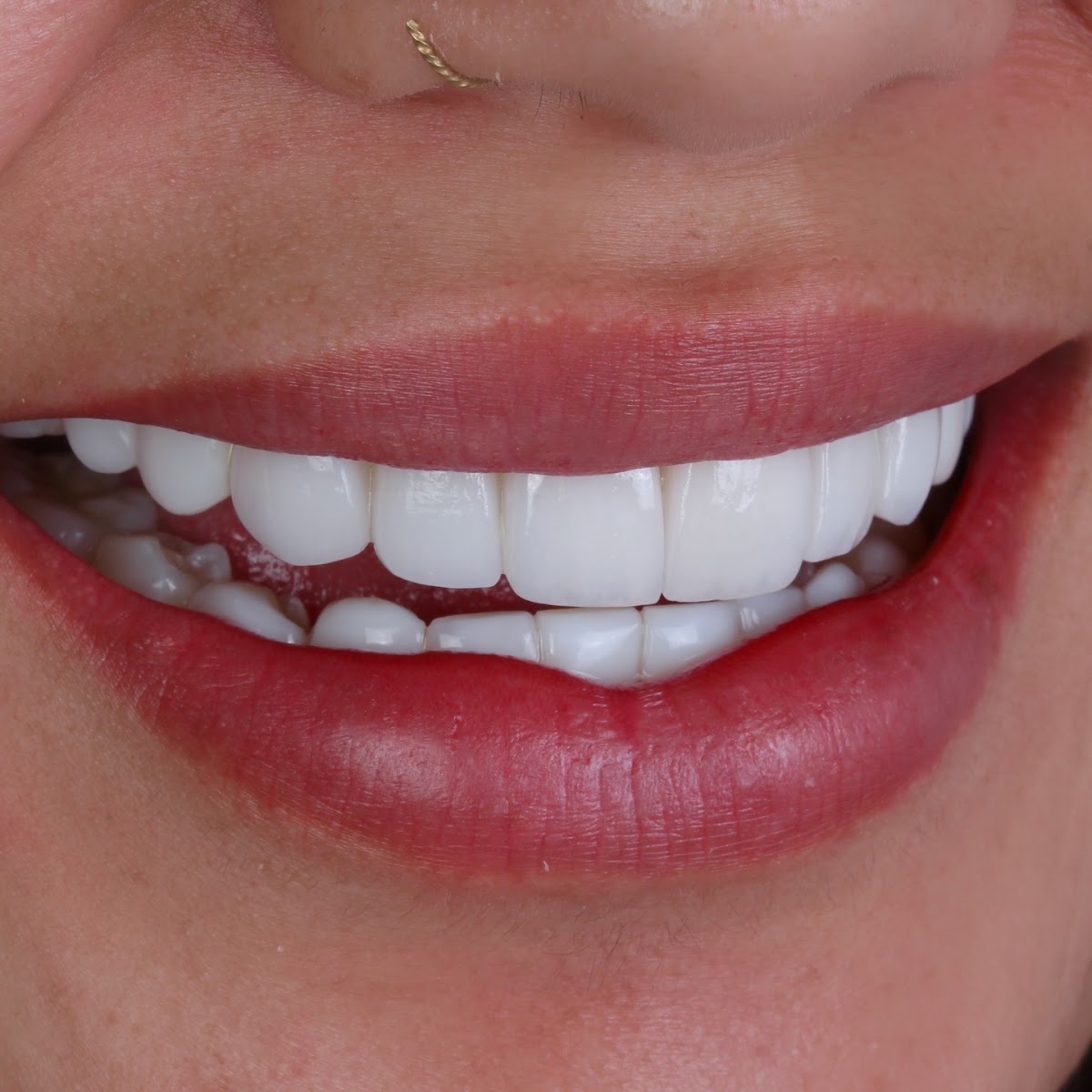 Dental Care Mexico