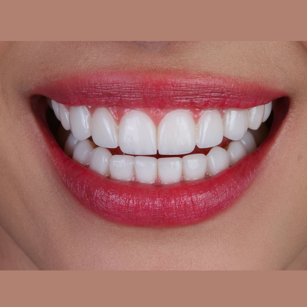 Dental Care Mexico — foto 3