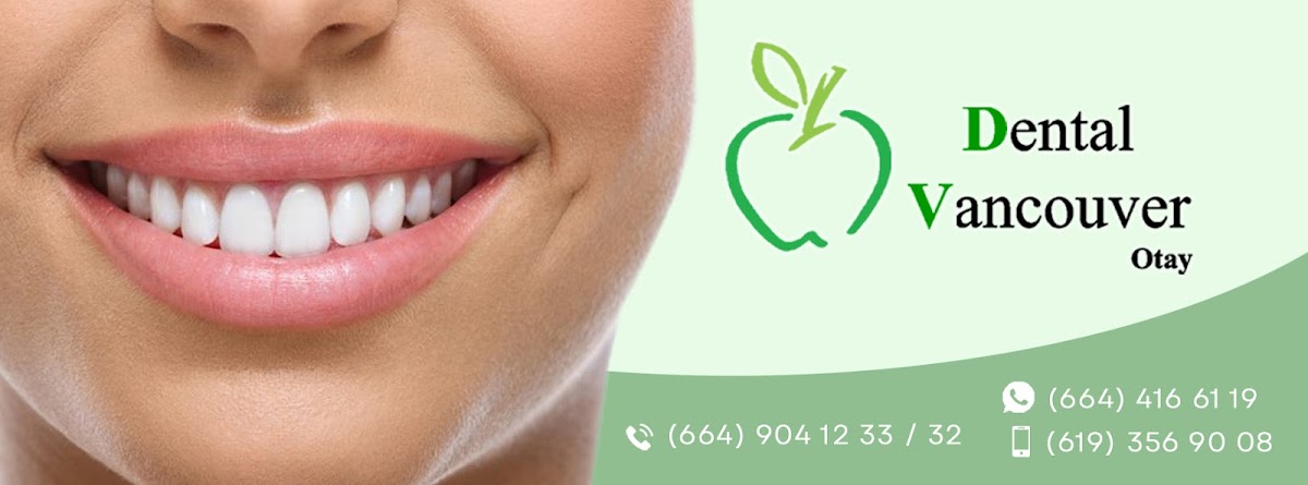 Dental Vancouver Otay — foto 4
