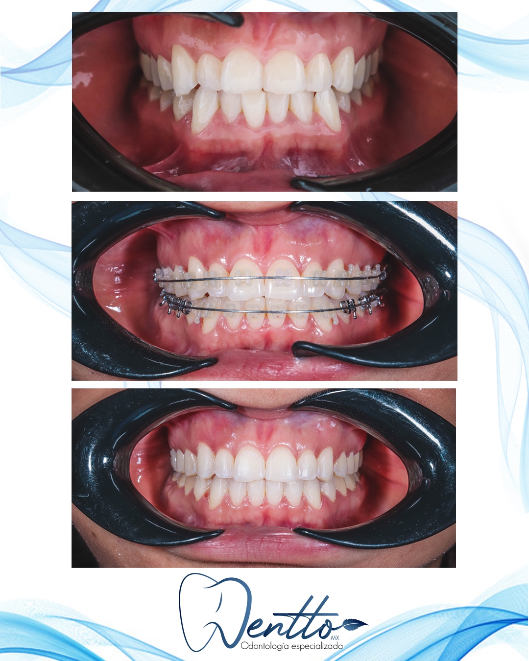 Dentto mx — foto 2