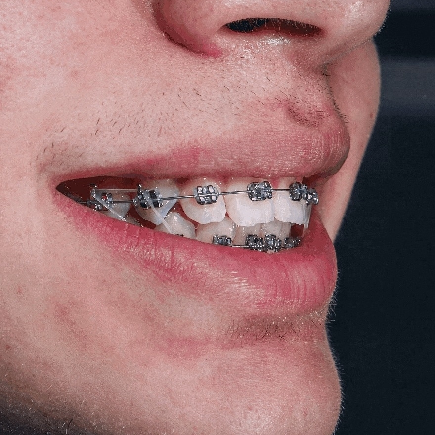 Dentto mx — foto 4