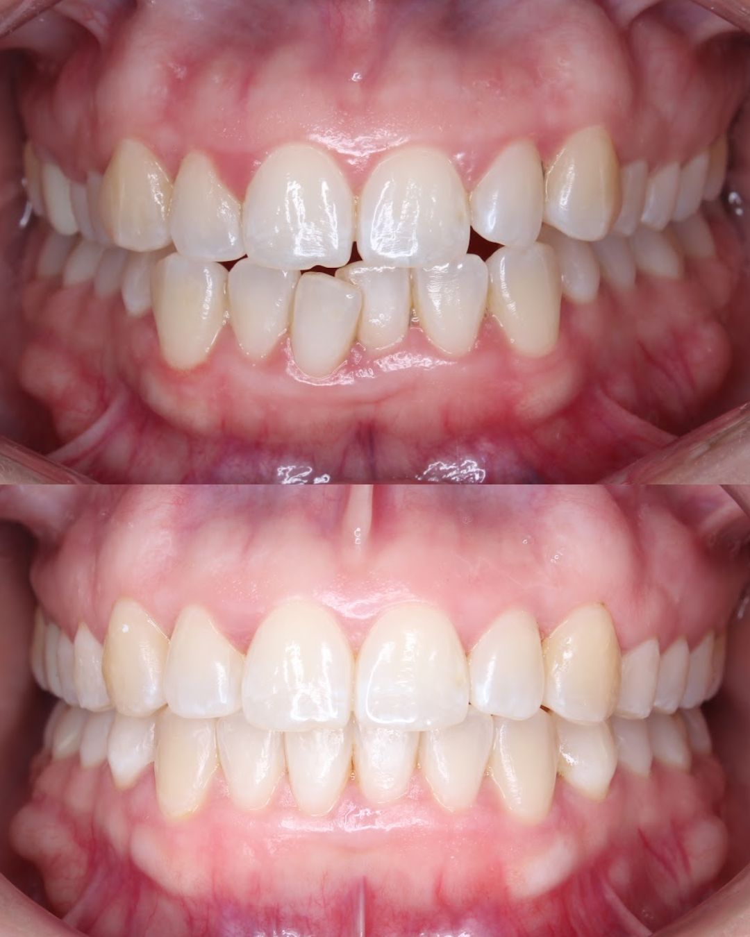 Omme Care - Centro de Salud Dental Dentista San Pedro — foto 2
