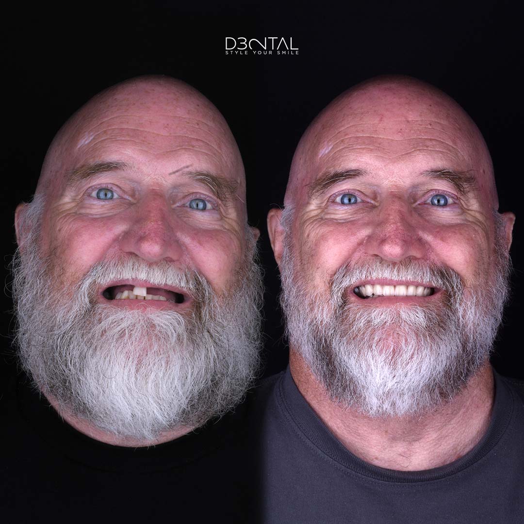 Dental 32, Otras zonas