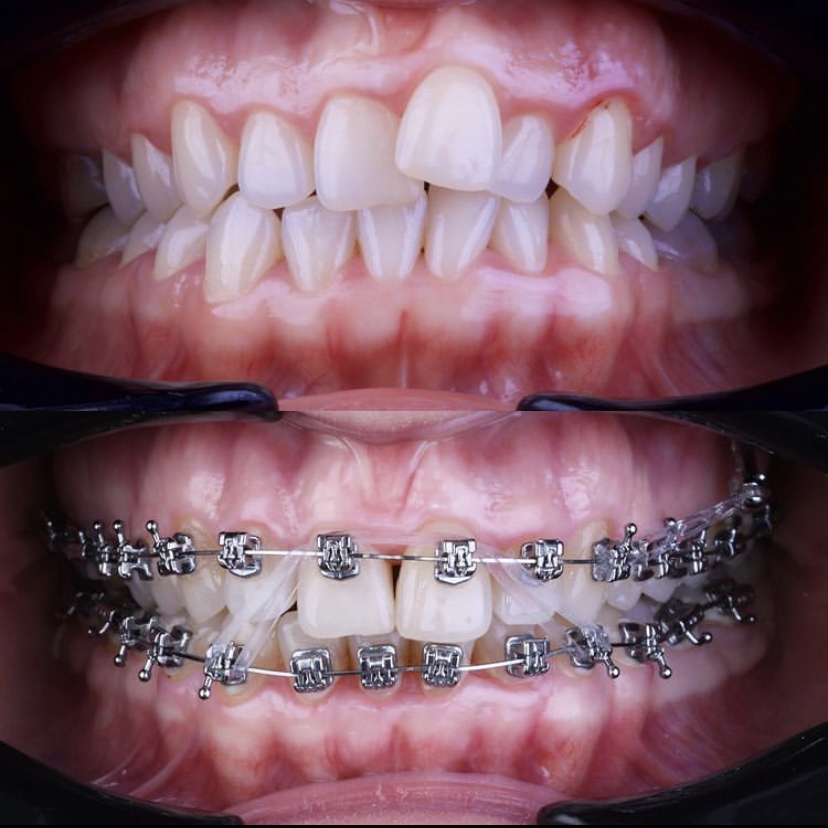 OrthoSmile. Ortodoncia y Odontología estética, Otras zonas
