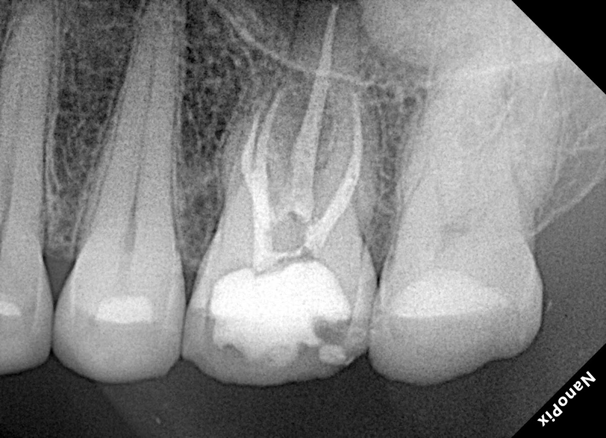 Endodoncia CDMX Maleni Mercado — foto 4