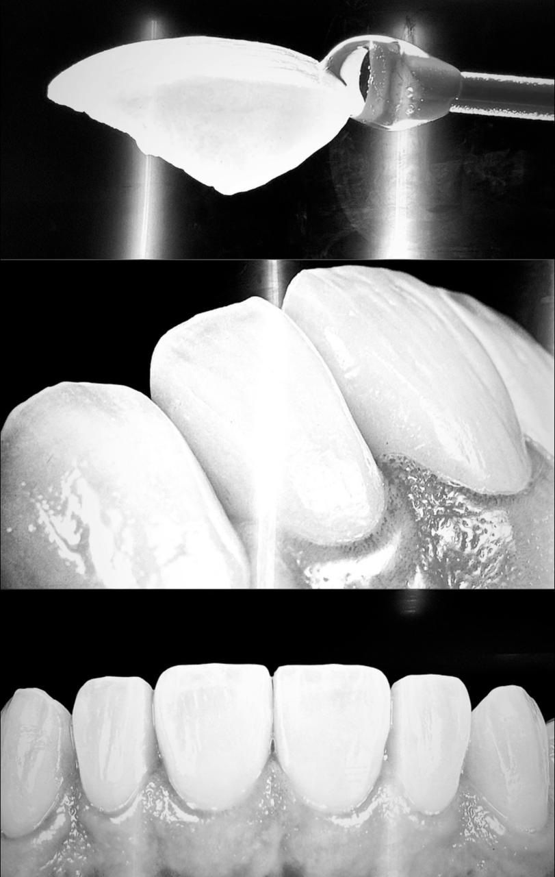 Dental Premium, Otras zonas