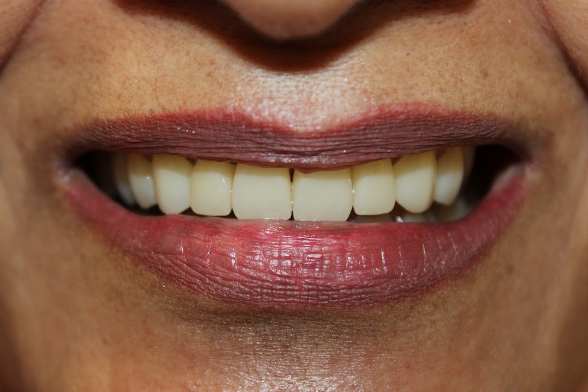 Dental Premium — foto 2