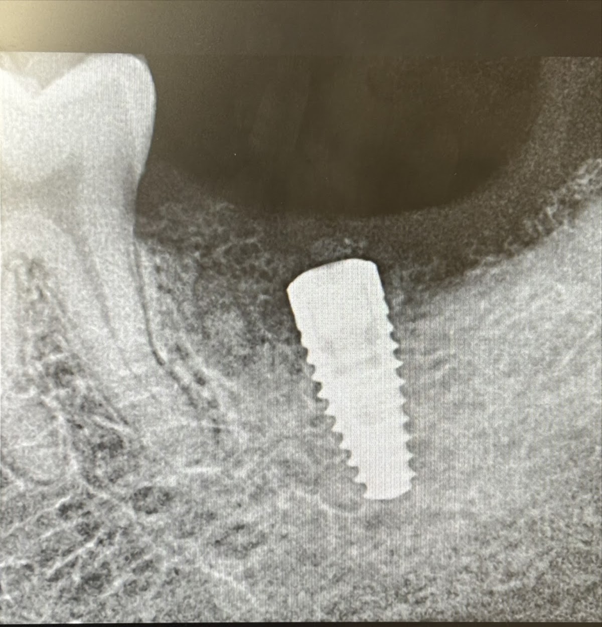 Dental Premium — foto 4