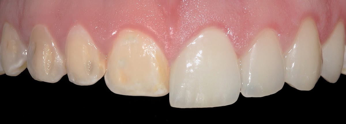 GRUPO DENTAL ANTEA