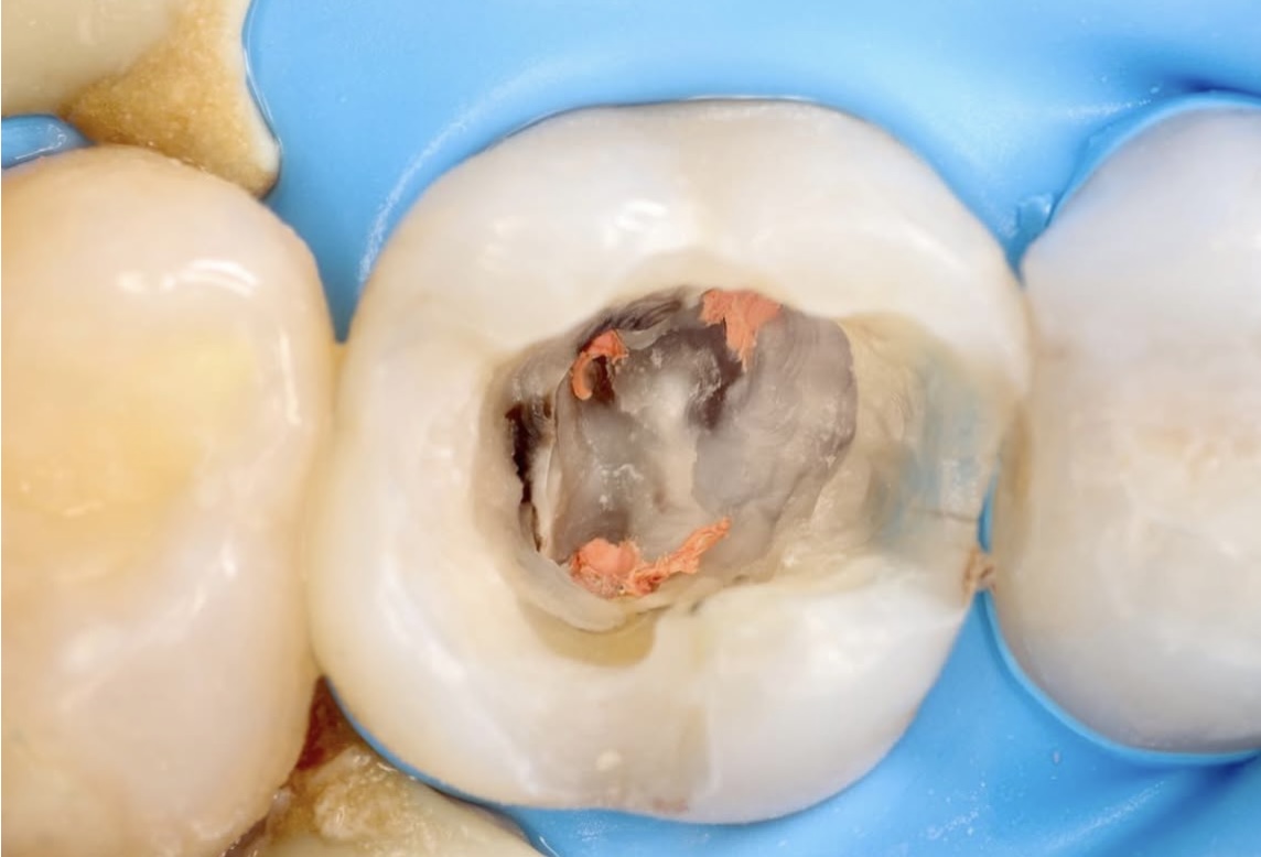 Clínica Dental Dra. Mariangela G. Mirabal Rehabilitación oral & Implantes — foto 3