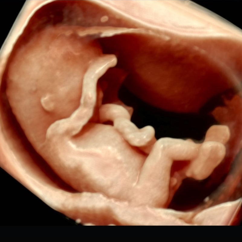 Ginecólogo Dr. Josuet García. — foto 4