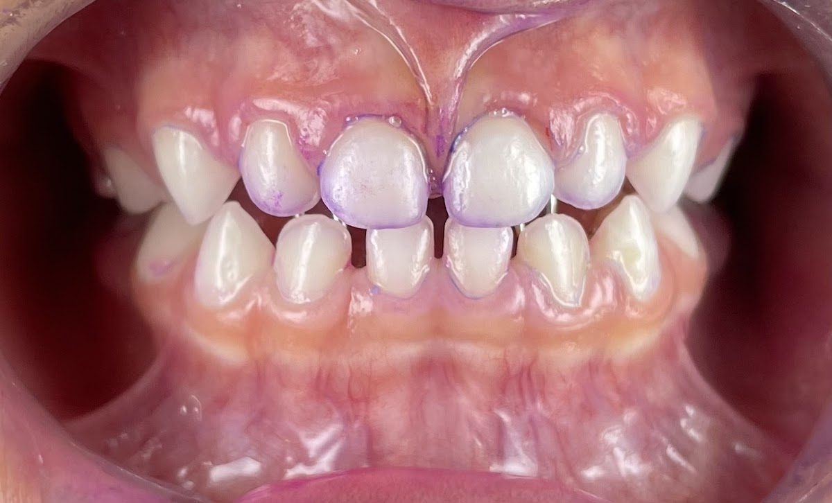 Dental Familiar Providencia — foto 3