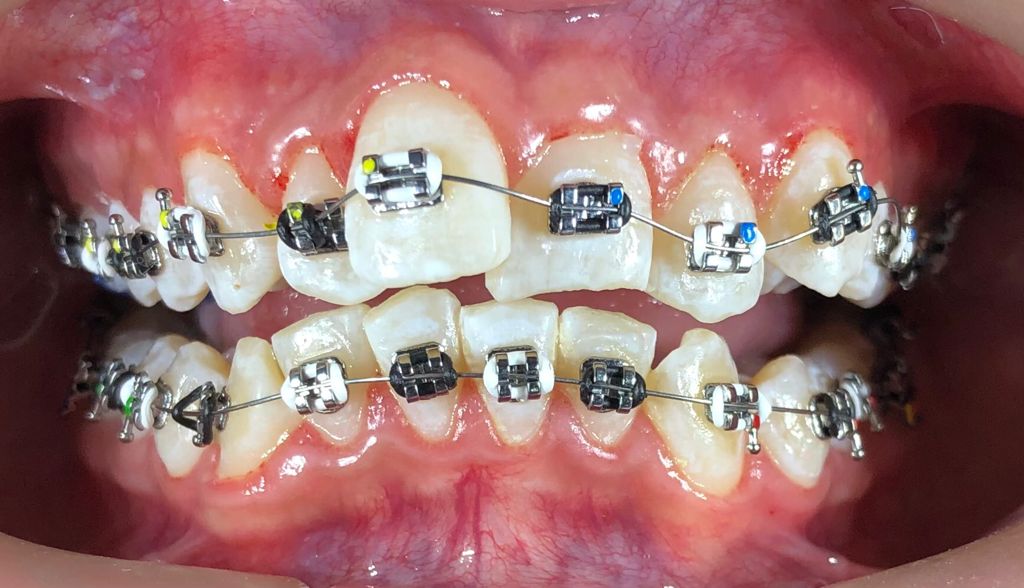 Dental Familiar Providencia — foto 4