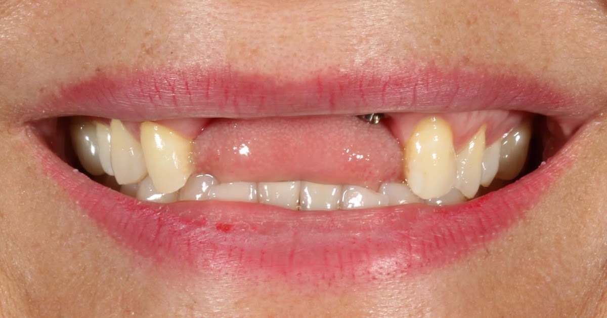 Alineapro Dental Queretaro — foto 4