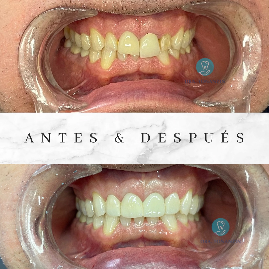Dra. Tonanzin dentista — foto 2