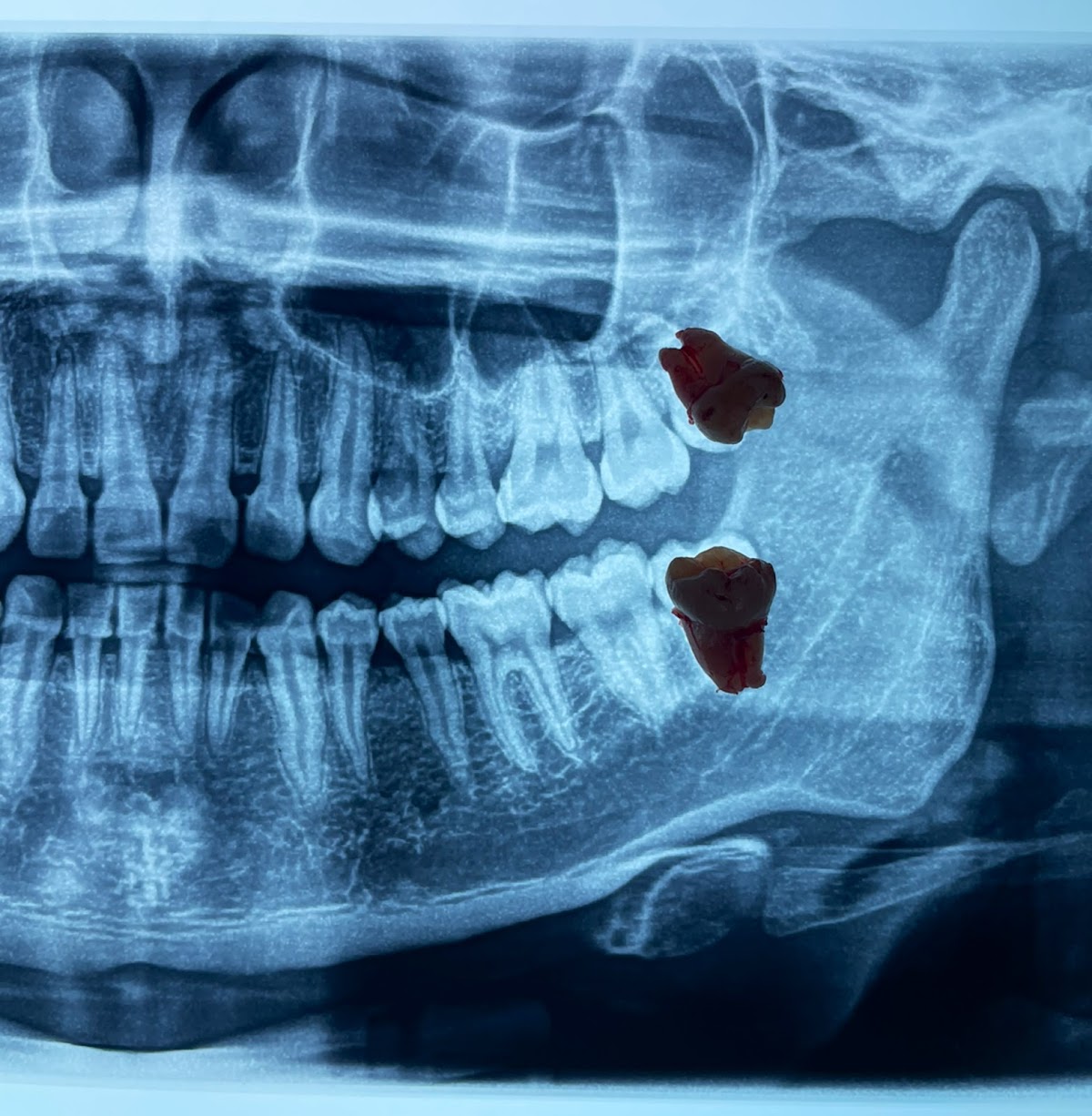 Dra. Tonanzin dentista — foto 4