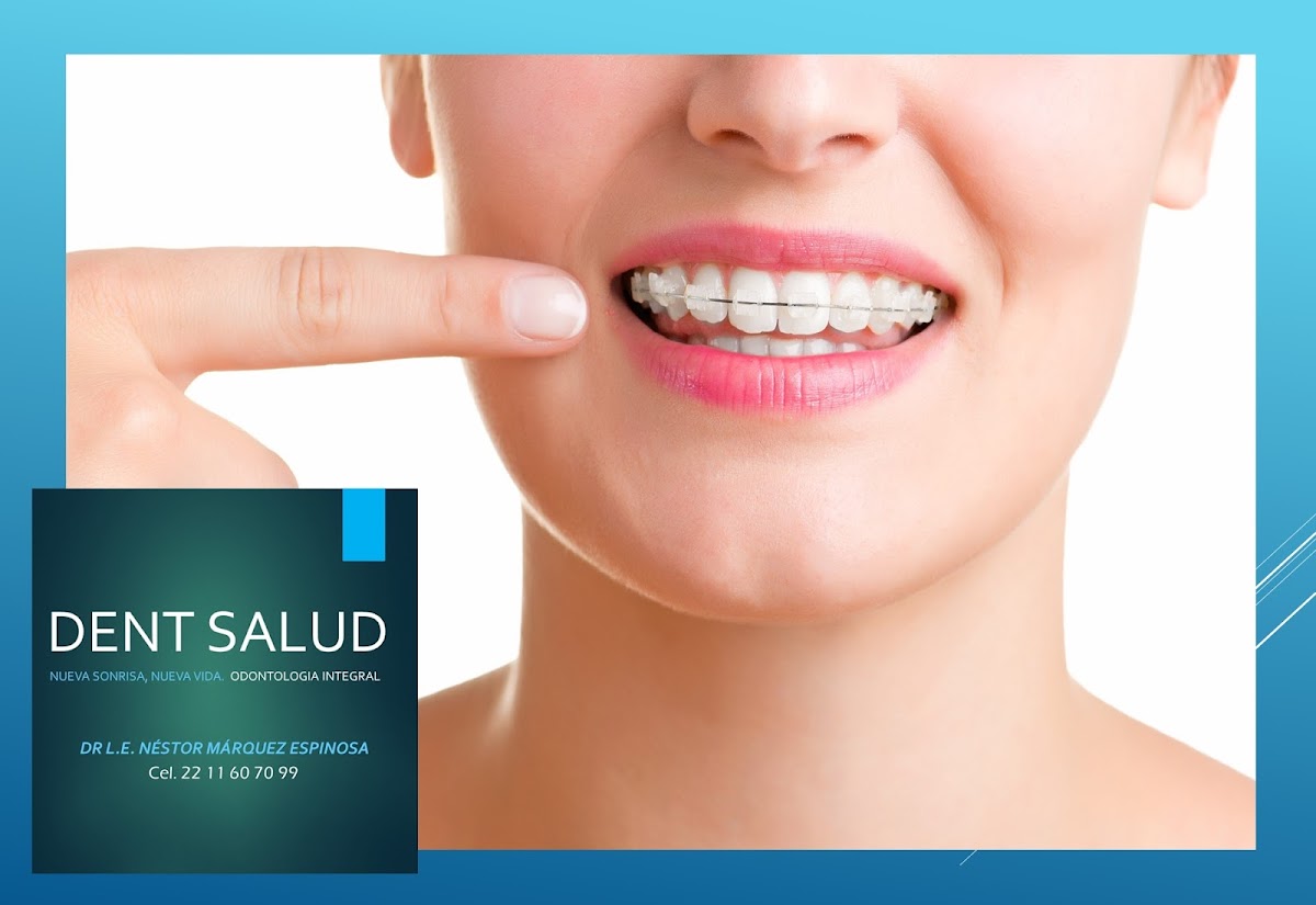 Dent Salud — foto 4