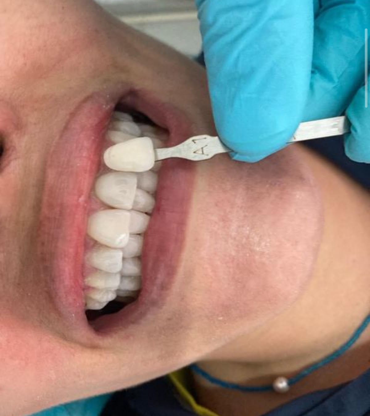 Dentista Guadalajara - Dr. Víctor Martínez — foto 2
