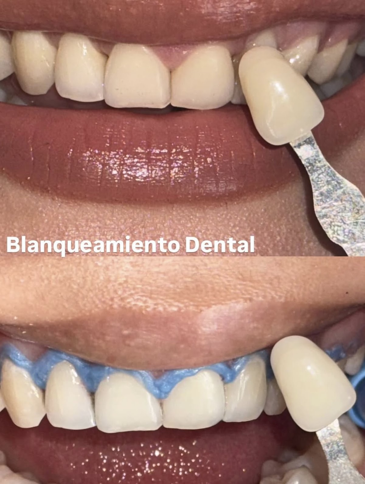 Dentista Guadalajara - Dr. Víctor Martínez — foto 3