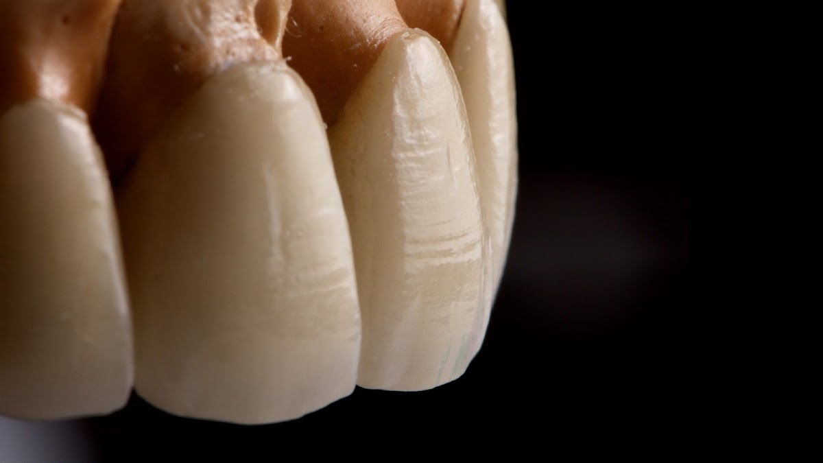 Dr. Ricardo Lemus, Rehabilitación Oral Estética e Implantología Dental, Altozano