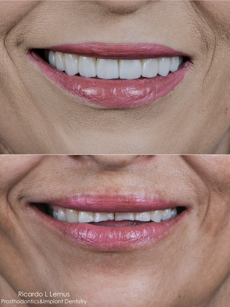 Dr. Ricardo Lemus, Rehabilitación Oral Estética e Implantología Dental — foto 2