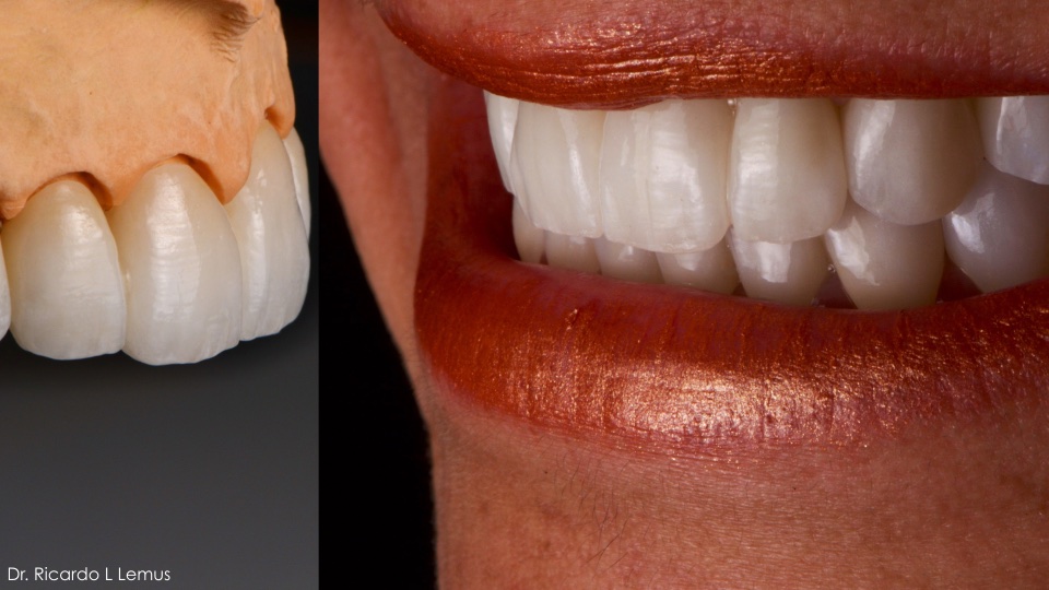 Dr. Ricardo Lemus, Rehabilitación Oral Estética e Implantología Dental — foto 3