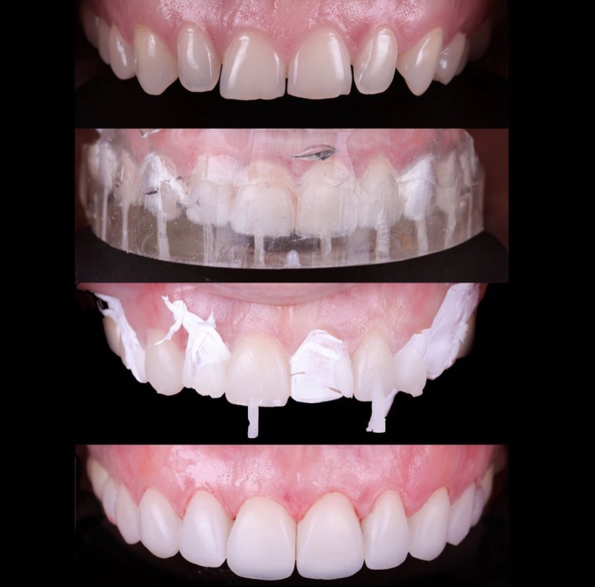 Dental Laser Juriquilla