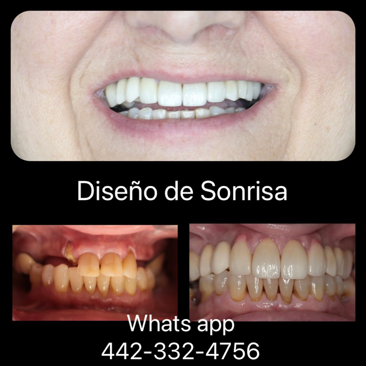 Dental Laser Juriquilla — foto 2