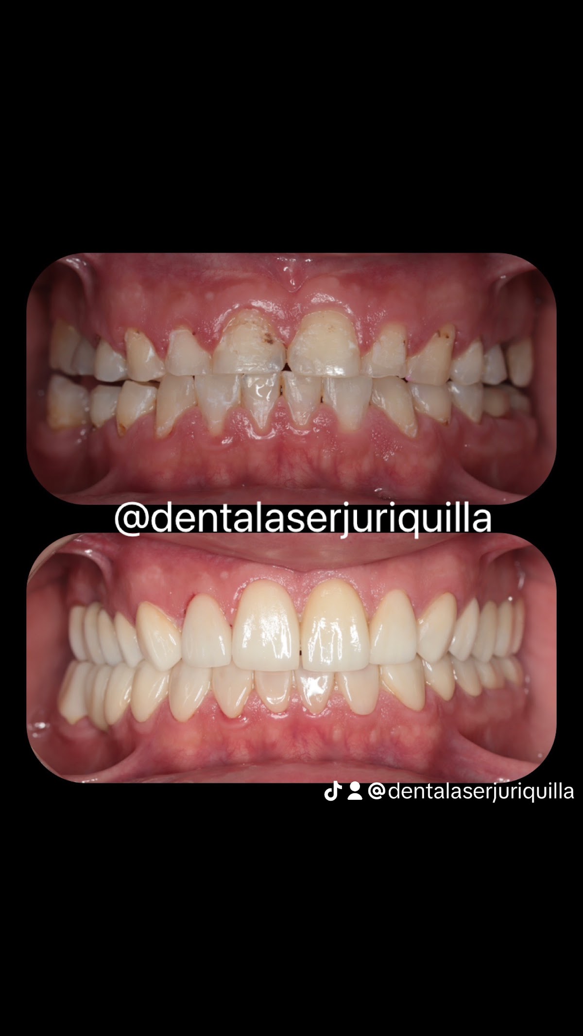 Dental Laser Juriquilla — foto 3
