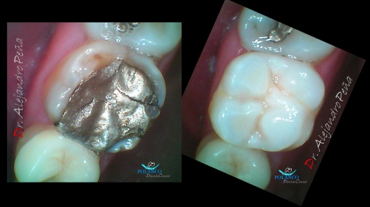 Dentista en Polanco - Dr. Alejandro Peña Vega — foto 4
