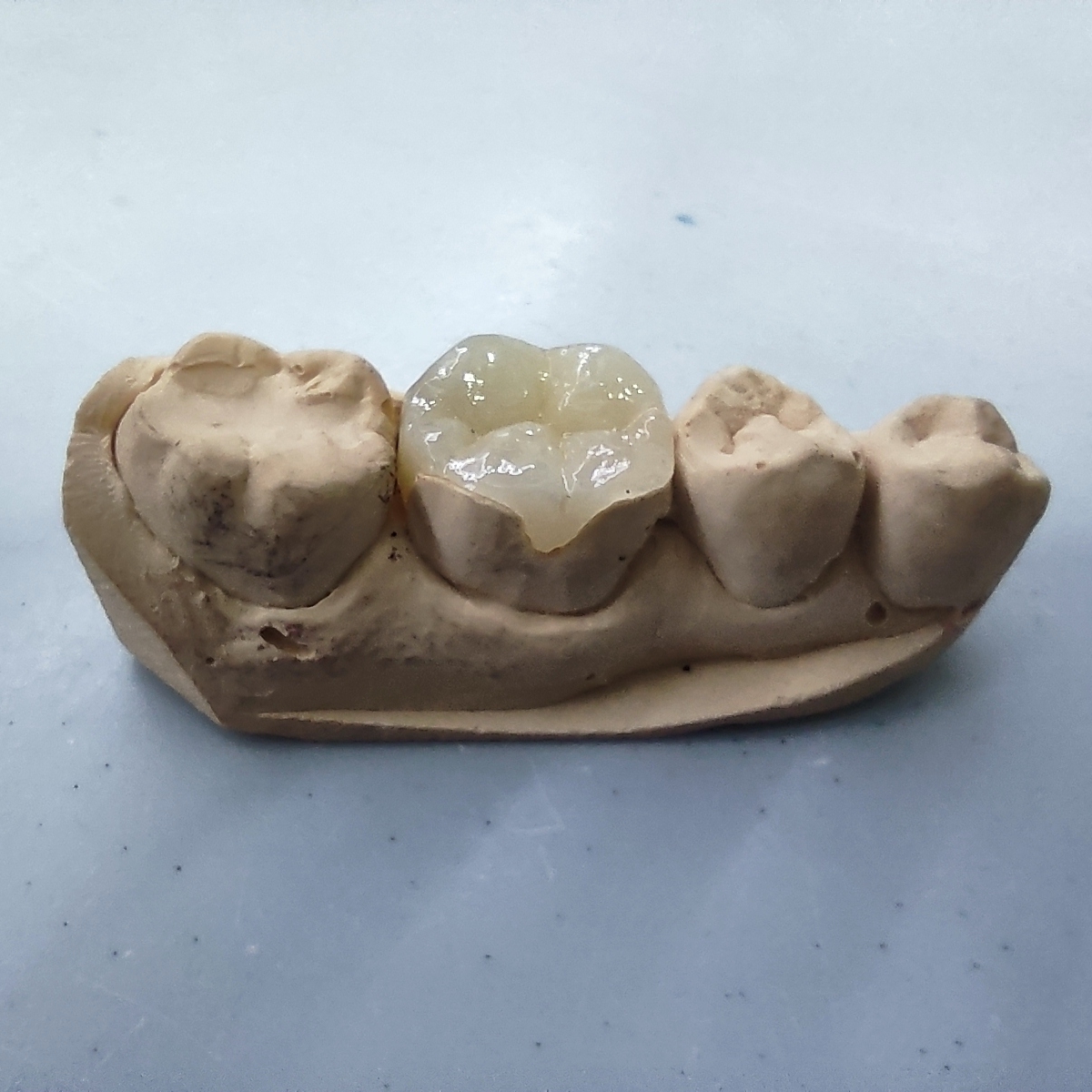 Dentaris - Dentista / odontologo en Guadalajara — foto 3