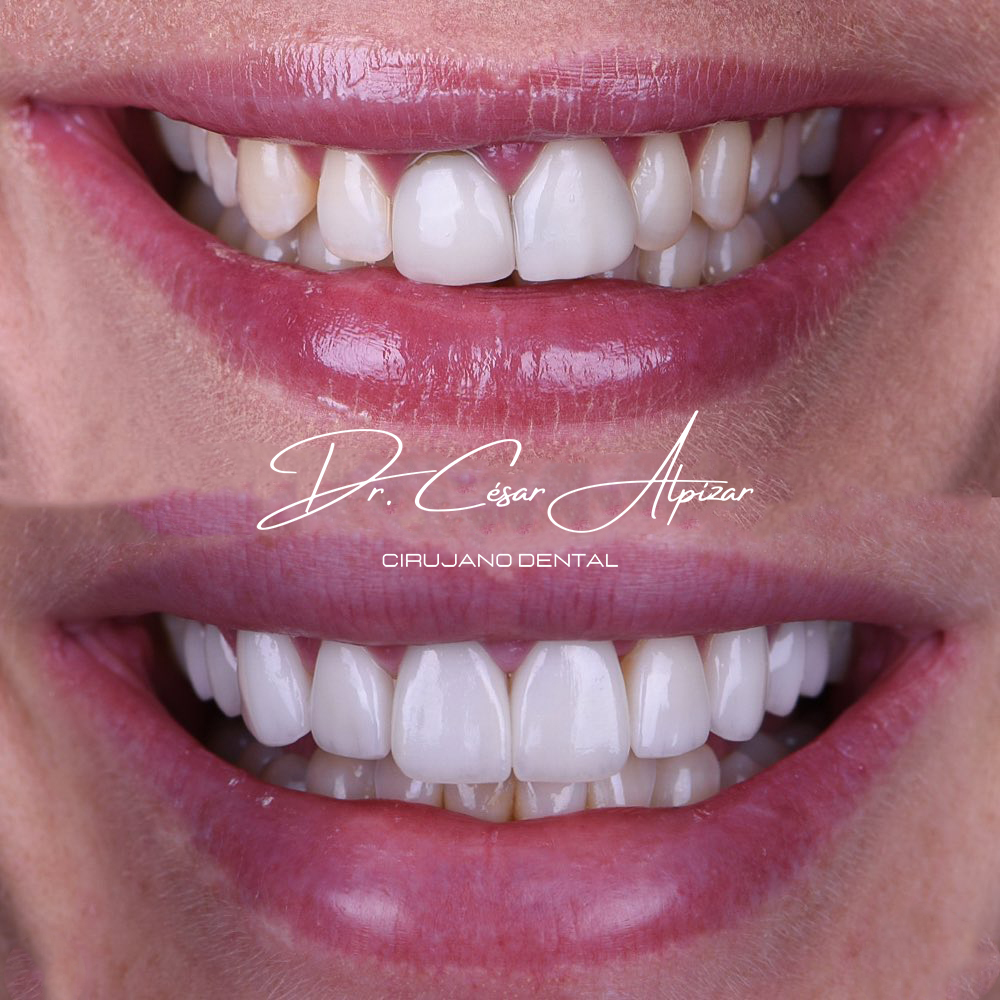 DENTISTA URGENCIAS DENTALES 24 HORAS CLINICA REALDENT CONDESA — foto 4