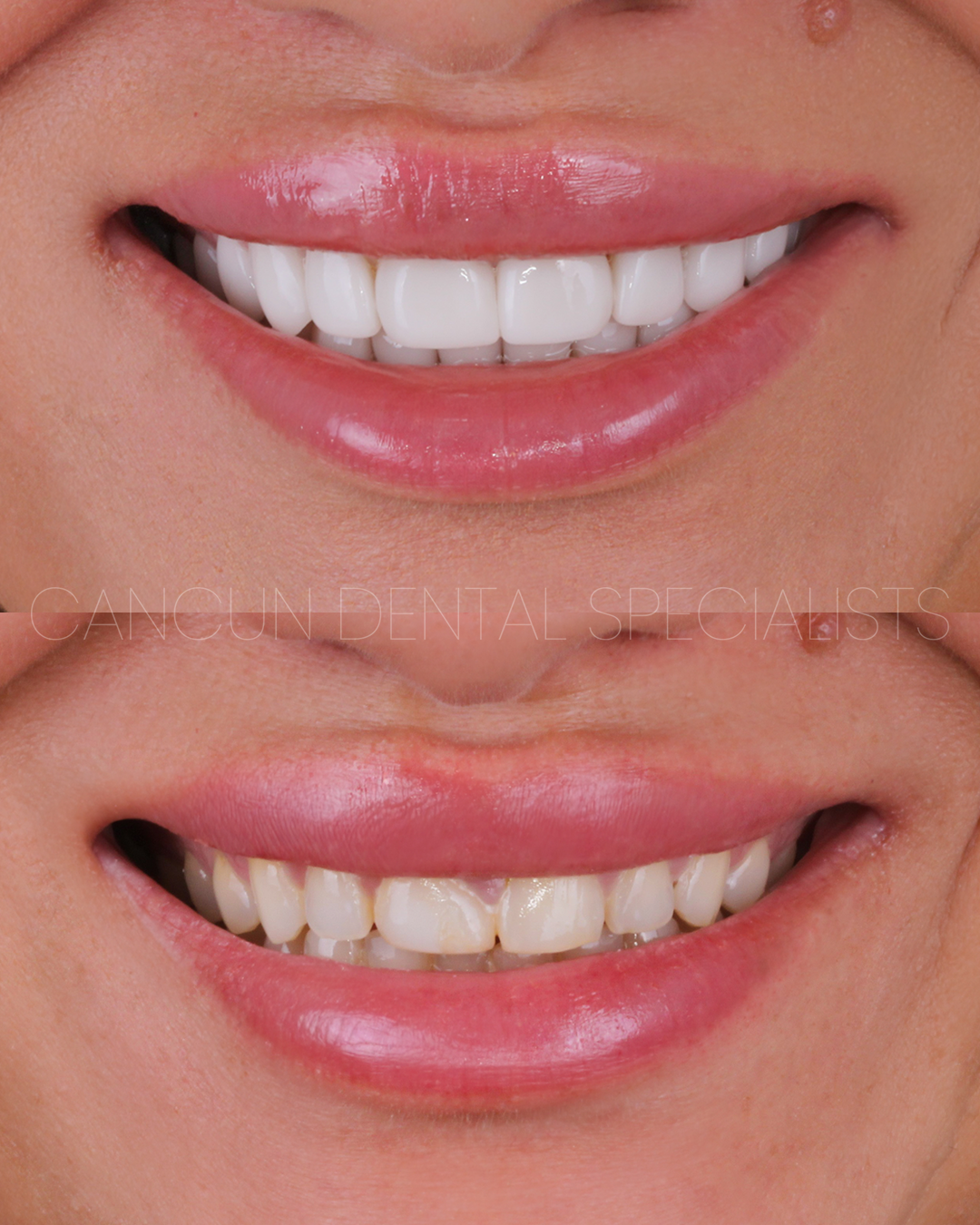 Cancun Dental Specialists — foto 2
